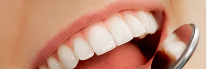 bright and beautiful teeth in a happy smile