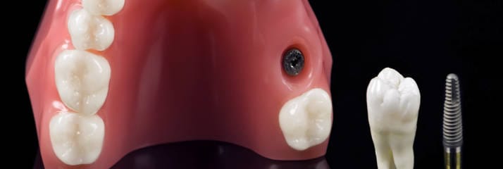 bright and beautiful teeth in a happy smile