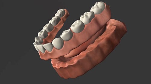 dentures image