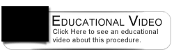 Dental Education Video - <h3>Placing Porcelain Veneers</h3>
